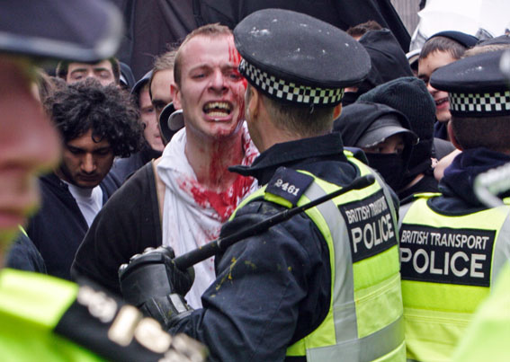 Bloody protestor & baton-wielding cop