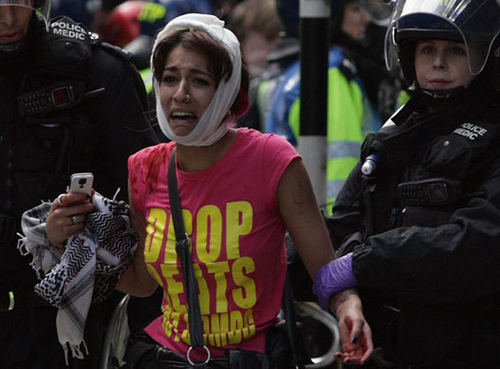 Injured woman at G20